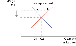 Supply-side unemployment